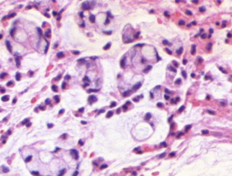 Histopathologisches Bild: Kolonschleimhaut